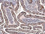 NDUFS3 Antibody in Immunohistochemistry (Paraffin) (IHC (P))