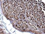 NDUFS3 Antibody in Immunohistochemistry (Paraffin) (IHC (P))