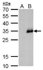 Neurogenin 1 Antibody in Western Blot (WB)