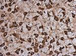 NMT1 Antibody in Immunohistochemistry (Paraffin) (IHC (P))