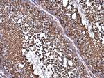 NMT1 Antibody in Immunohistochemistry (Paraffin) (IHC (P))