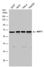 NMT1 Antibody in Western Blot (WB)