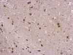 NPAS1 Antibody in Immunohistochemistry (Paraffin) (IHC (P))