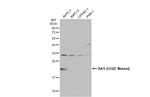 Ras (G12D Mutant) Antibody in Western Blot (WB)