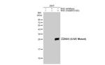 Ras (G12D Mutant) Antibody in Western Blot (WB)