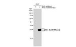 Ras (G12D Mutant) Antibody in Western Blot (WB)