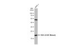 Ras (G12D Mutant) Antibody in Western Blot (WB)