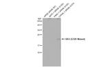 Ras (G12V Mutant) Antibody in Western Blot (WB)