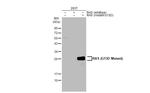 Ras (G13D Mutant) Antibody in Western Blot (WB)