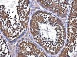 NSF Antibody in Immunohistochemistry (Paraffin) (IHC (P))