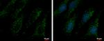 PEX14 Antibody in Immunocytochemistry (ICC/IF)