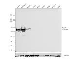 PLCB2 Antibody