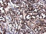 POLE Antibody in Immunohistochemistry (Paraffin) (IHC (P))