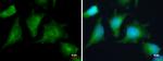 PRKAR2A Antibody in Immunocytochemistry (ICC/IF)