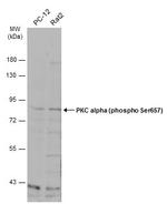 Phospho-PKC alpha (Ser657) Antibody in Western Blot (WB)