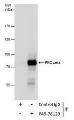 PKC zeta Antibody in Immunoprecipitation (IP)