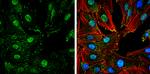 Phospho-FAK (Tyr407) Antibody in Immunocytochemistry (ICC/IF)