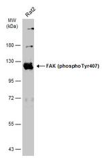 Phospho-FAK (Tyr407) Antibody in Western Blot (WB)