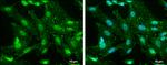 Phospho-FAK (Tyr576) Antibody in Immunocytochemistry (ICC/IF)