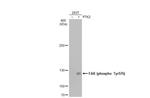 Phospho-FAK (Tyr576) Antibody in Western Blot (WB)