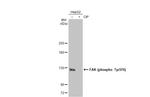 Phospho-FAK (Tyr576) Antibody in Western Blot (WB)