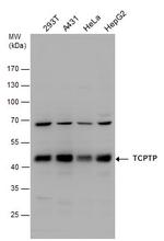 PTPN2 Antibody in Western Blot (WB)