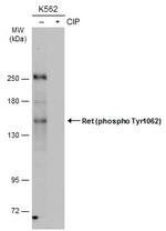 Phospho-RET (Tyr1062) Antibody in Western Blot (WB)