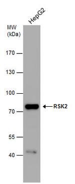 RSK2 Antibody in Western Blot (WB)