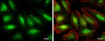 SKP2 Antibody in Immunocytochemistry (ICC/IF)