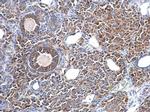 Fascin Antibody in Immunohistochemistry (Paraffin) (IHC (P))