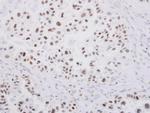 SP1 Antibody in Immunohistochemistry (Paraffin) (IHC (P))