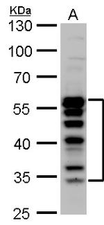 TCF7 Antibody in Western Blot (WB)