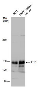 TTF1 Antibody in Western Blot (WB)