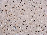 Twist1/Twist2 Antibody in Immunohistochemistry (Paraffin) (IHC (P))