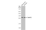 Twist1/Twist2 Antibody in Western Blot (WB)