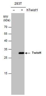 Twist1/Twist2 Antibody in Western Blot (WB)