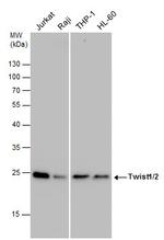 Twist1/Twist2 Antibody in Western Blot (WB)