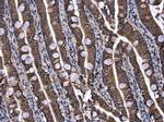 UQCRB Antibody in Immunohistochemistry (Paraffin) (IHC (P))