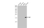 VIP Antibody in Western Blot (WB)