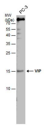 VIP Antibody in Western Blot (WB)