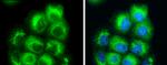 RAB7A Antibody in Immunocytochemistry (ICC/IF)