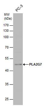 PLA2G7 Antibody in Western Blot (WB)