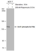 Phospho-ULK1 (Ser758) Antibody in Western Blot (WB)