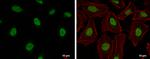 Cullin 4B Antibody in Immunocytochemistry (ICC/IF)