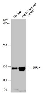 SMARCA5 Antibody in Western Blot (WB)