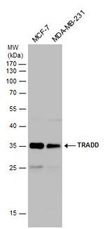 TRADD Antibody in Western Blot (WB)