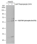 Phospho-SQSTM1 (Ser272) Antibody in Western Blot (WB)