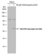 Phospho-SQSTM1 (Ser349) Antibody in Western Blot (WB)