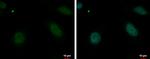 MBD4 Antibody in Immunocytochemistry (ICC/IF)