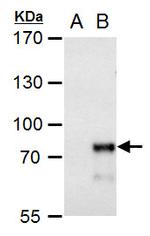 MBD4 Antibody in Western Blot (WB)